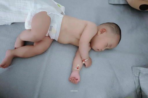 高唐宝宝头上长痱子